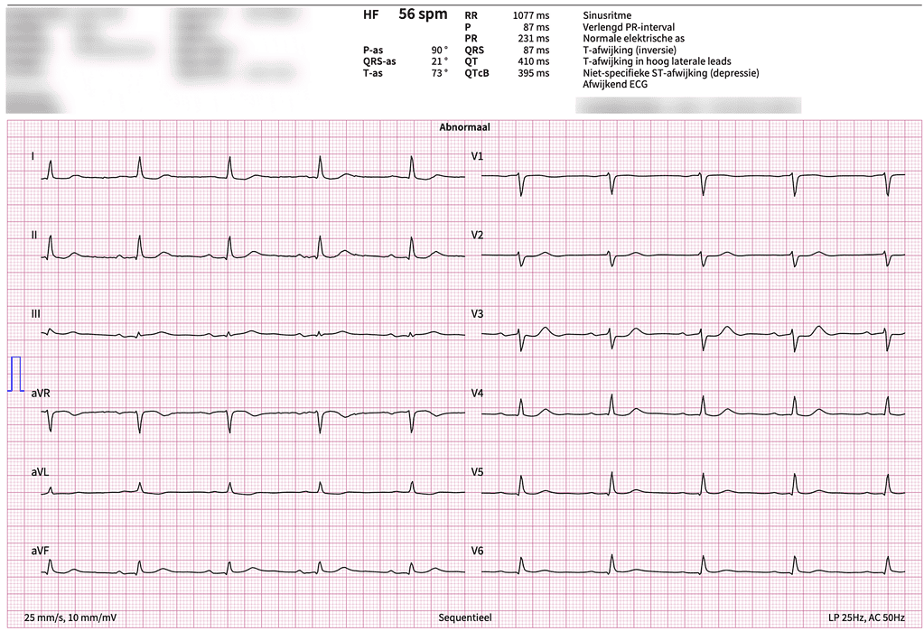 ECG Interpretation Tools Compared – Why PMcardio Stands Out ECG Interpretation Tools Compared – Why PMcardio Stands Out