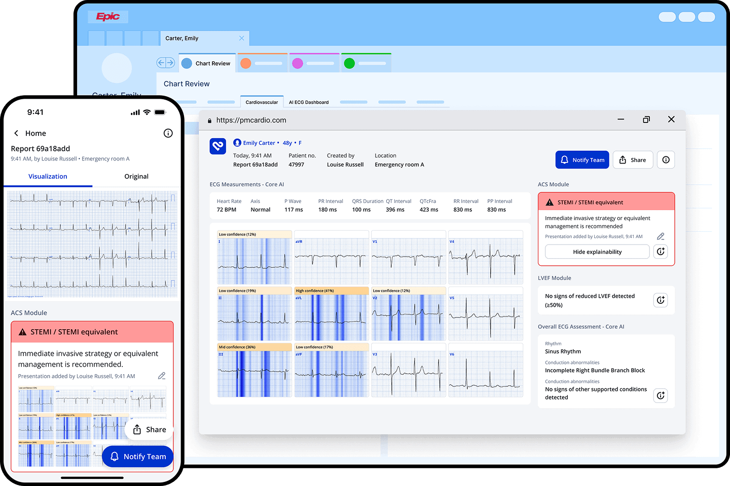 PMcardio: AI-Powered ECG Interpretation PMcardio for Organizations dashboard and mobile app displaying ECG analysis, STEMI detection, and EHR integration