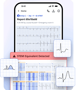 PMcardio STEMI AI ECG Model | Queen of Hearts