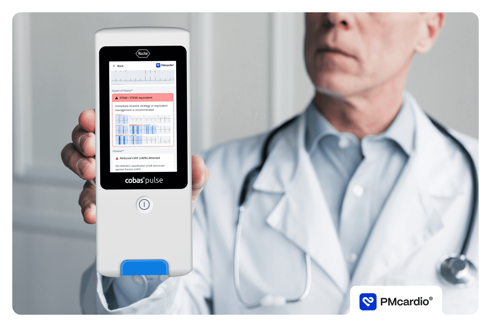 Doctor holding Roche cobas® pulse point-of-care device displaying PMcardio AI-powered ECG interpretation for real-time heart attack detection at the patient bedside.