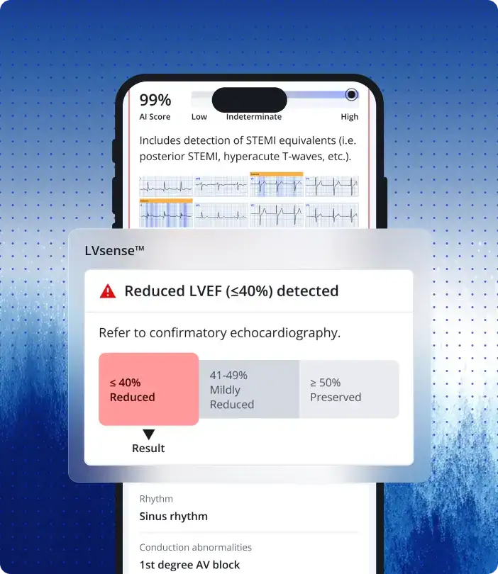 PMcardio App