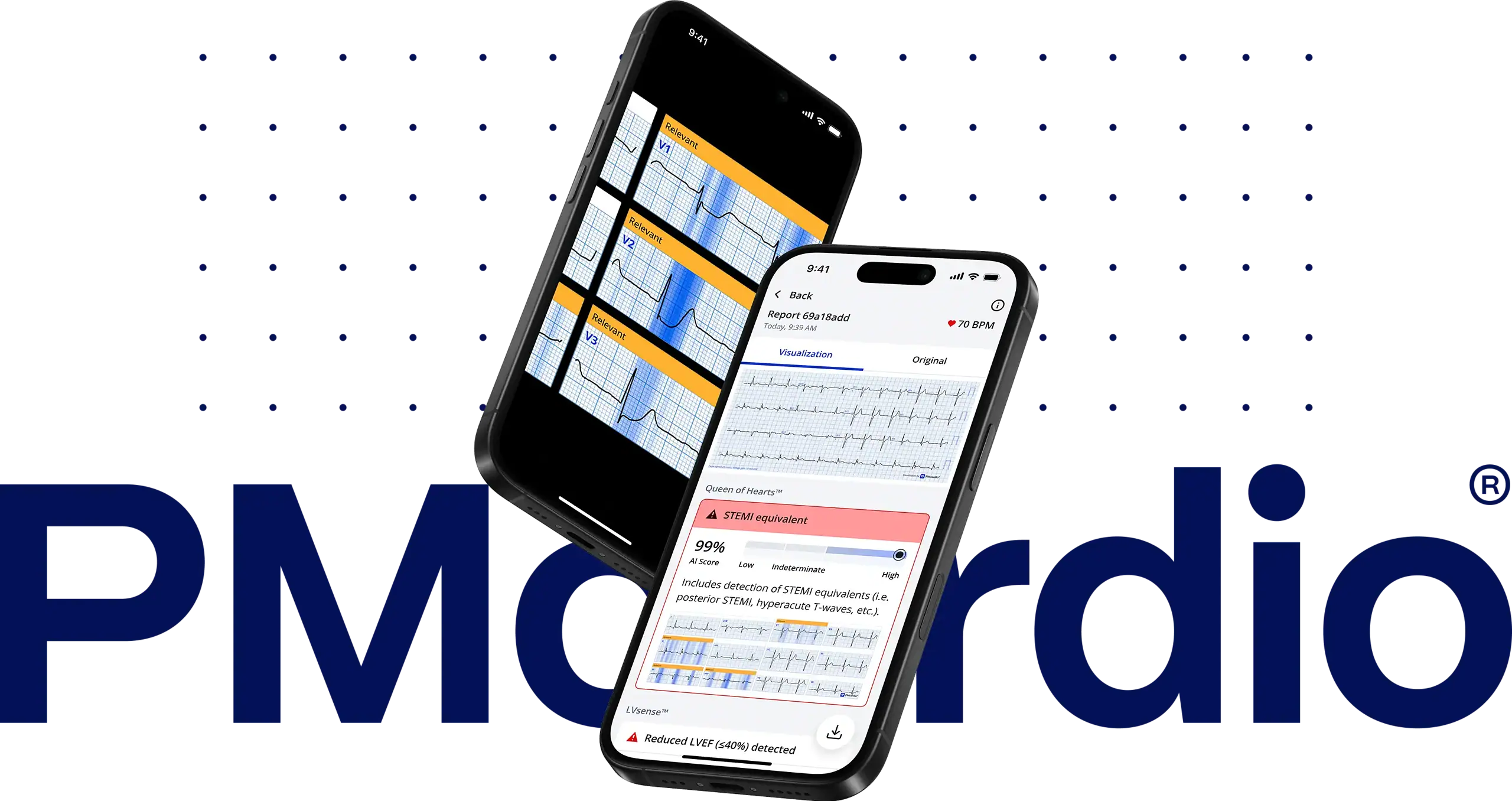 PMcardio App