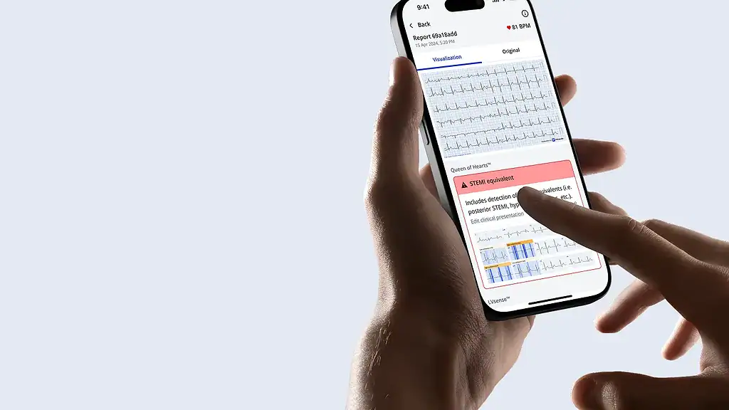 PMcardio App