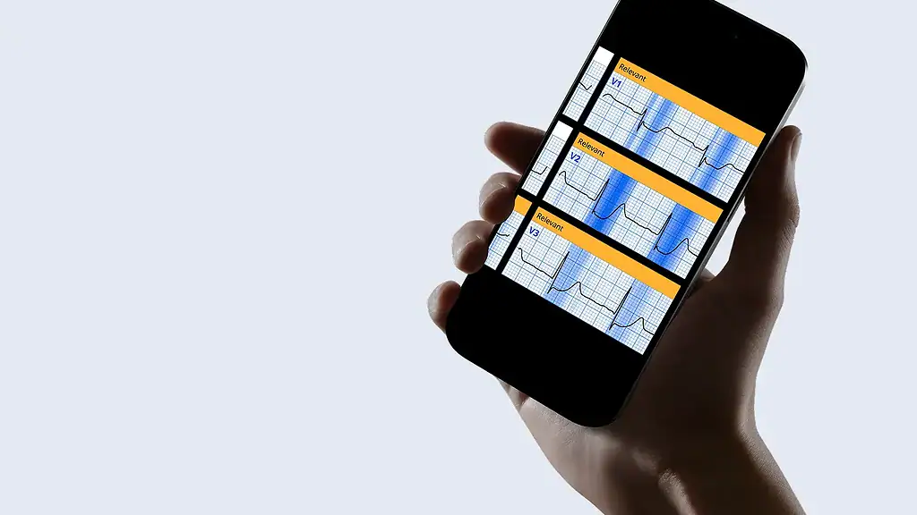 PMcardio App