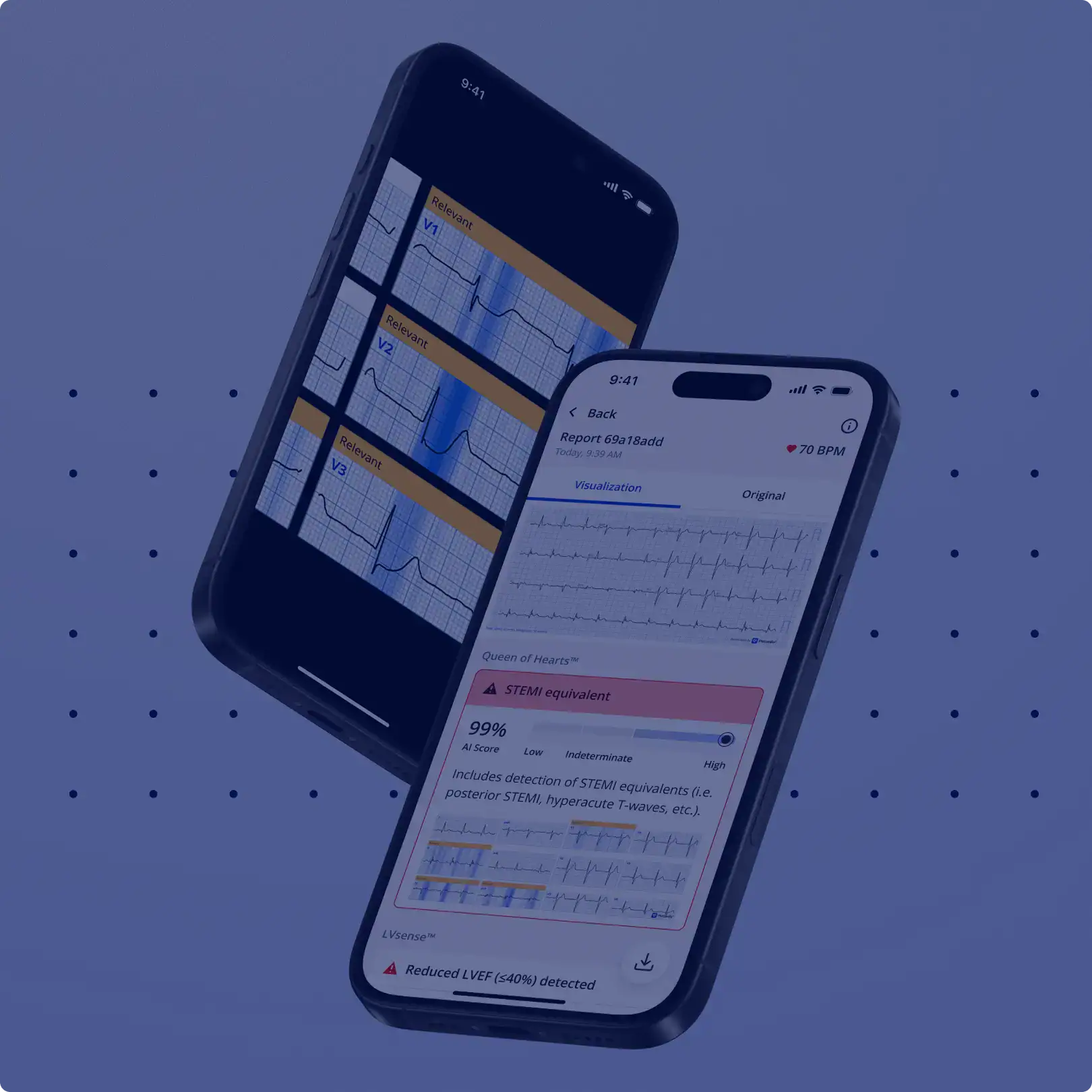 PMcardio for Organizations