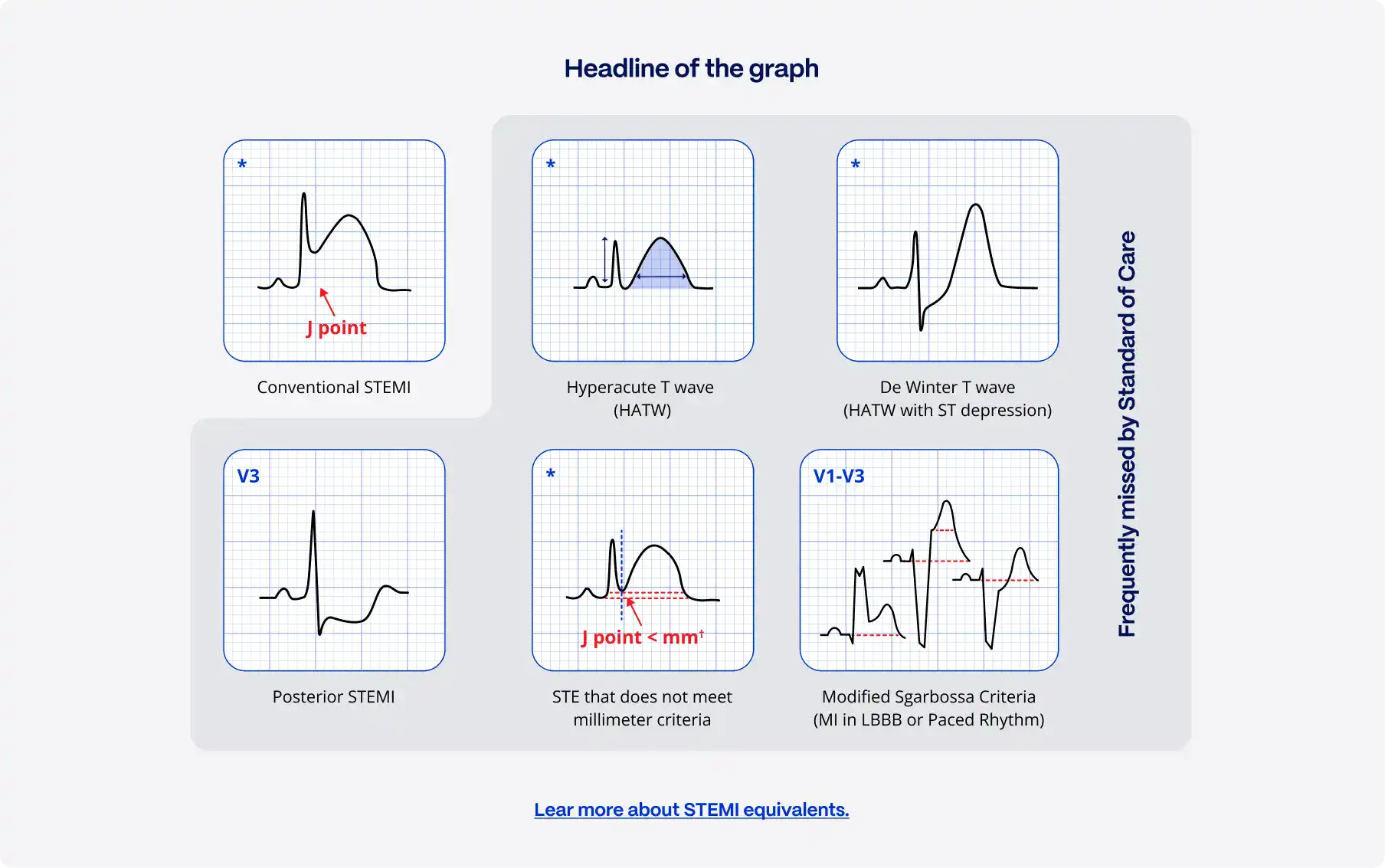 50% of heart attacks do not meet classic ECG-based STEMI criteria