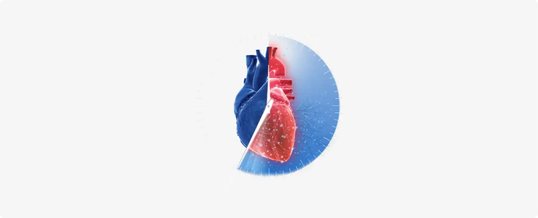 80% of STEMI patients presenting to Non-PCI centers experience reperfusion delays