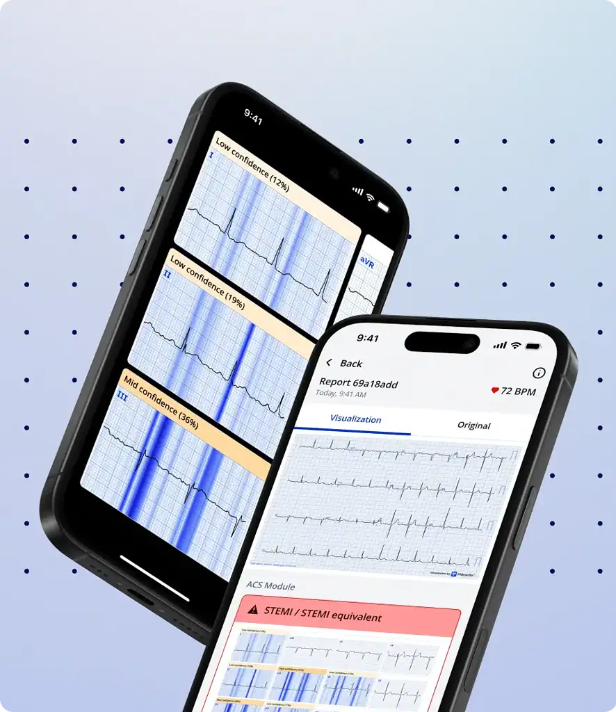 PMcardio: AI-Powered ECG Interpretation
