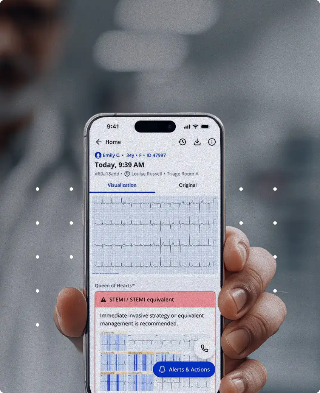 PMcardio: AI-Powered ECG Interpretation